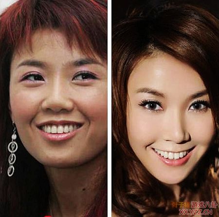 娱乐圈女明星大饼脸惊变锥子